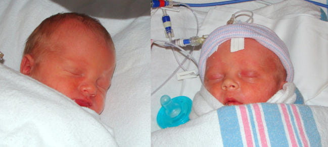 Two newborn babies are wrapped tightly in blankets and connected to vital sign monitoring equipment