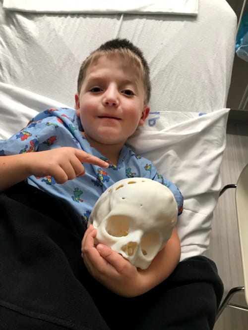 A boy in a bed holds a 3D model of his skull