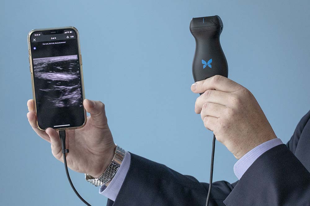 Closeup of a smartphone screen showing an image of an ultrasound gathered by the Butterfly device, which a man is holding next to it.