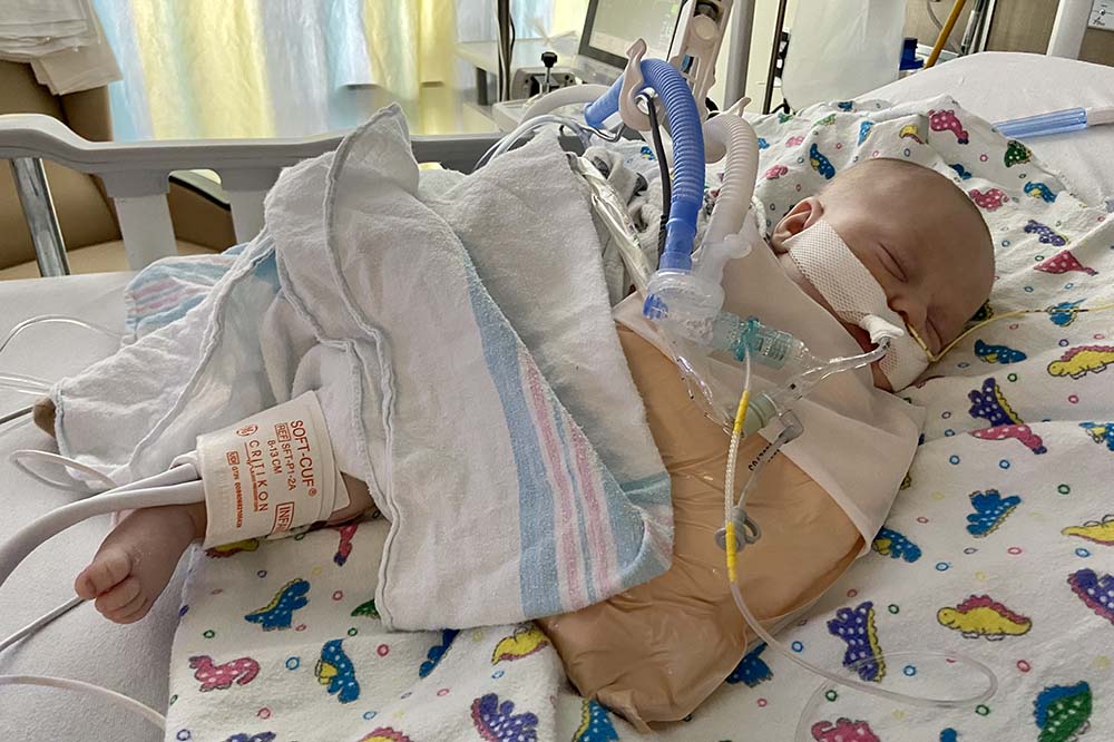 Baby boy struggles with virus that's filling up children's ICUs