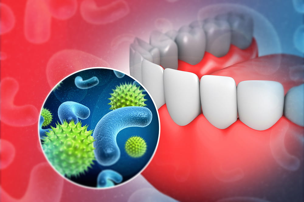 3D illustration of human tooth with microscopic bacteria and viruses. Licensed from istock.com.
